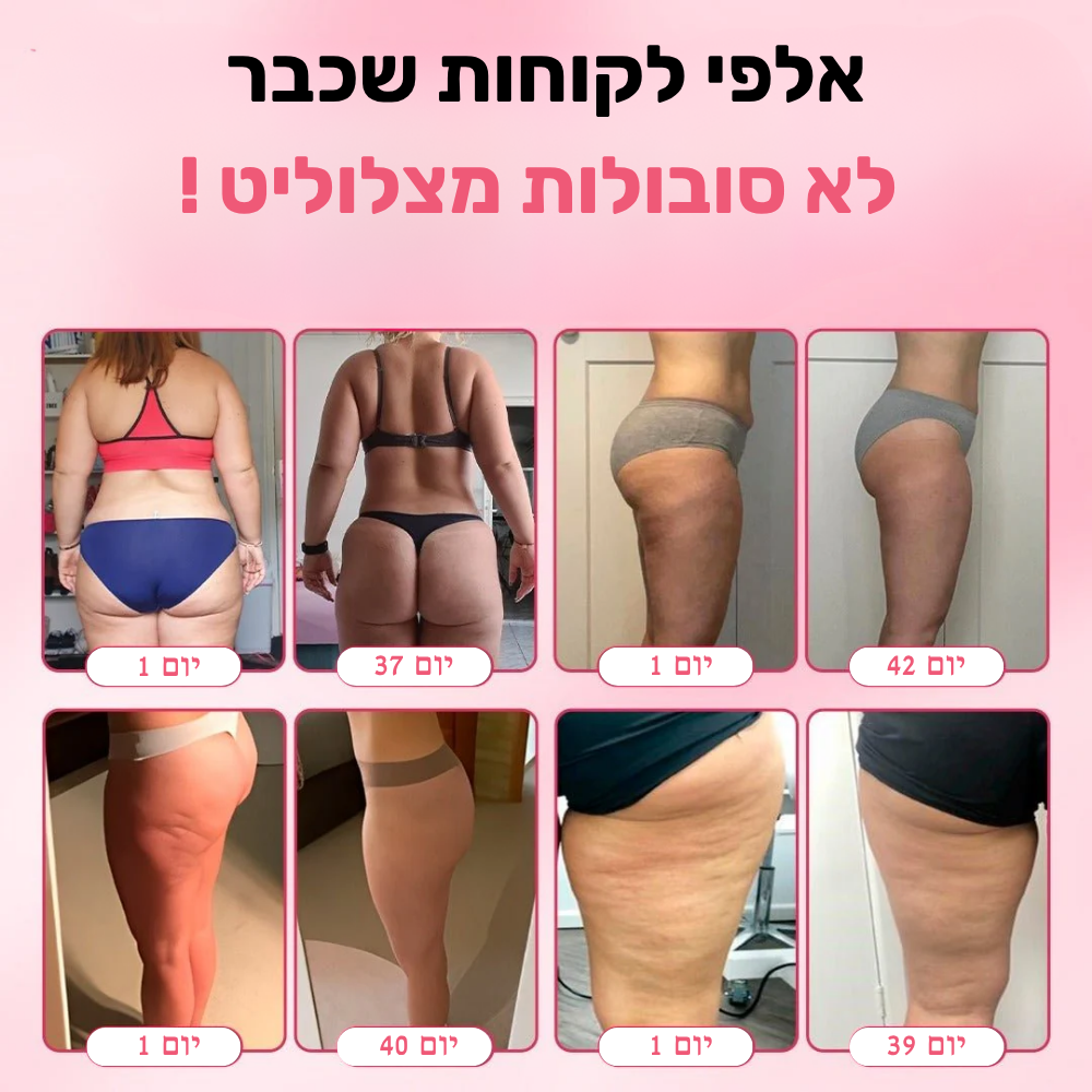 Bodyglow - מכשיר לחיטוב והידוק העור