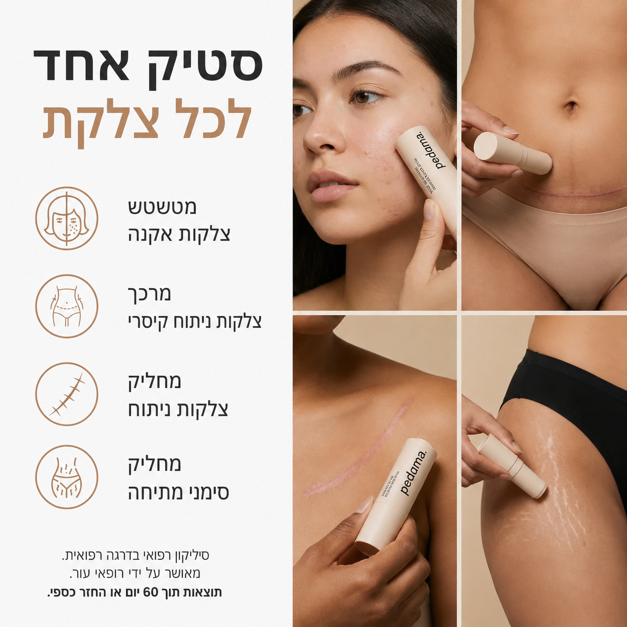 מיועד למי שכבר ניסתה הכל