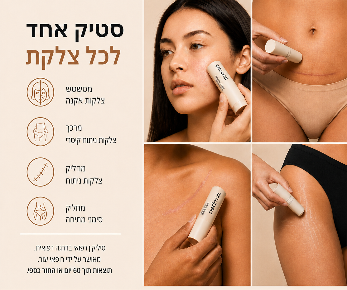 מיועד למי שכבר ניסתה הכל