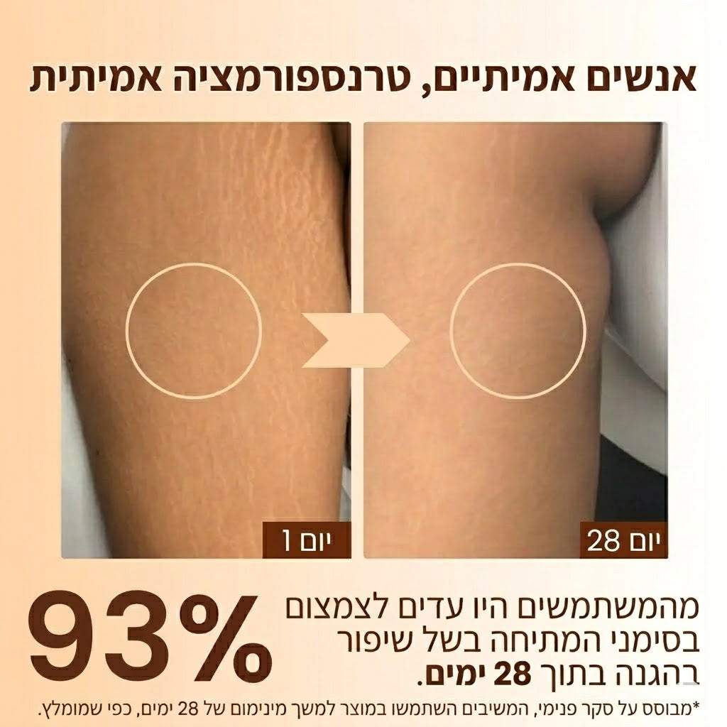 קרם לעור עודף וסימני מתיחה של פדמה