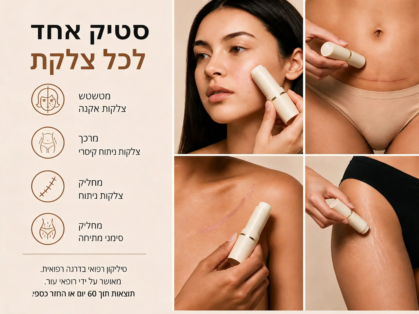 מיועד למי שכבר ניסתה הכל